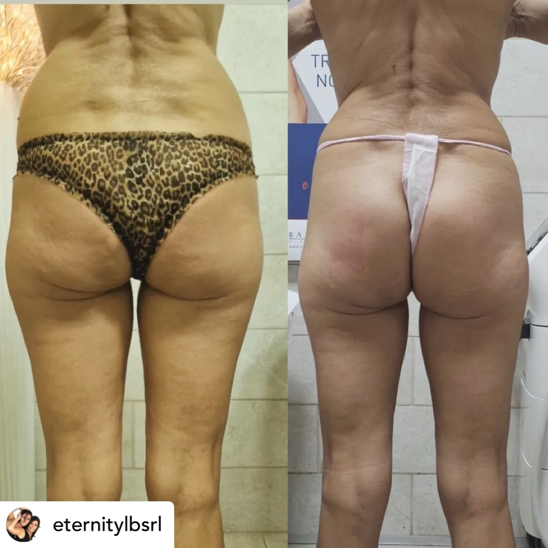Before and after