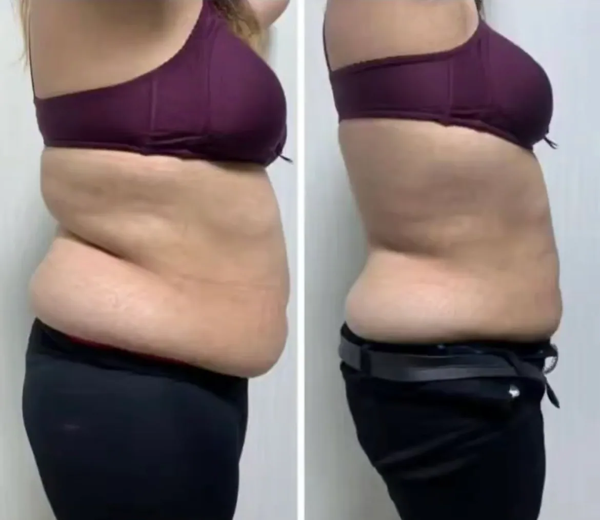 Before and after