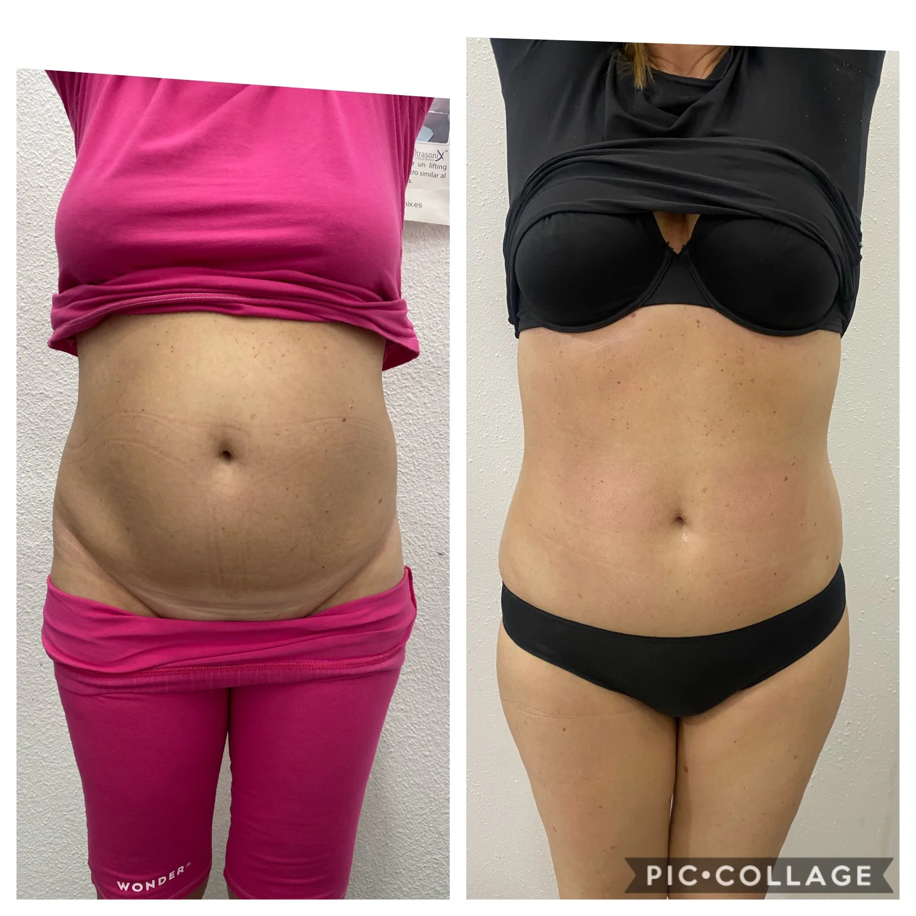 Before and after